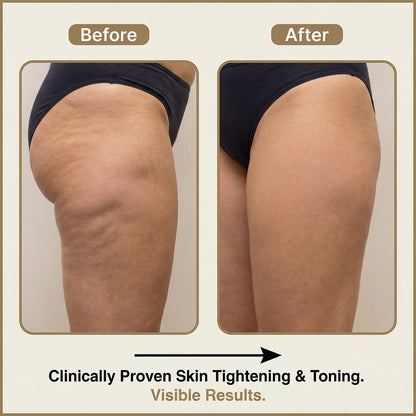 Ultrasonic Body Sculpting Massager – At-Home Firming & Contour Support