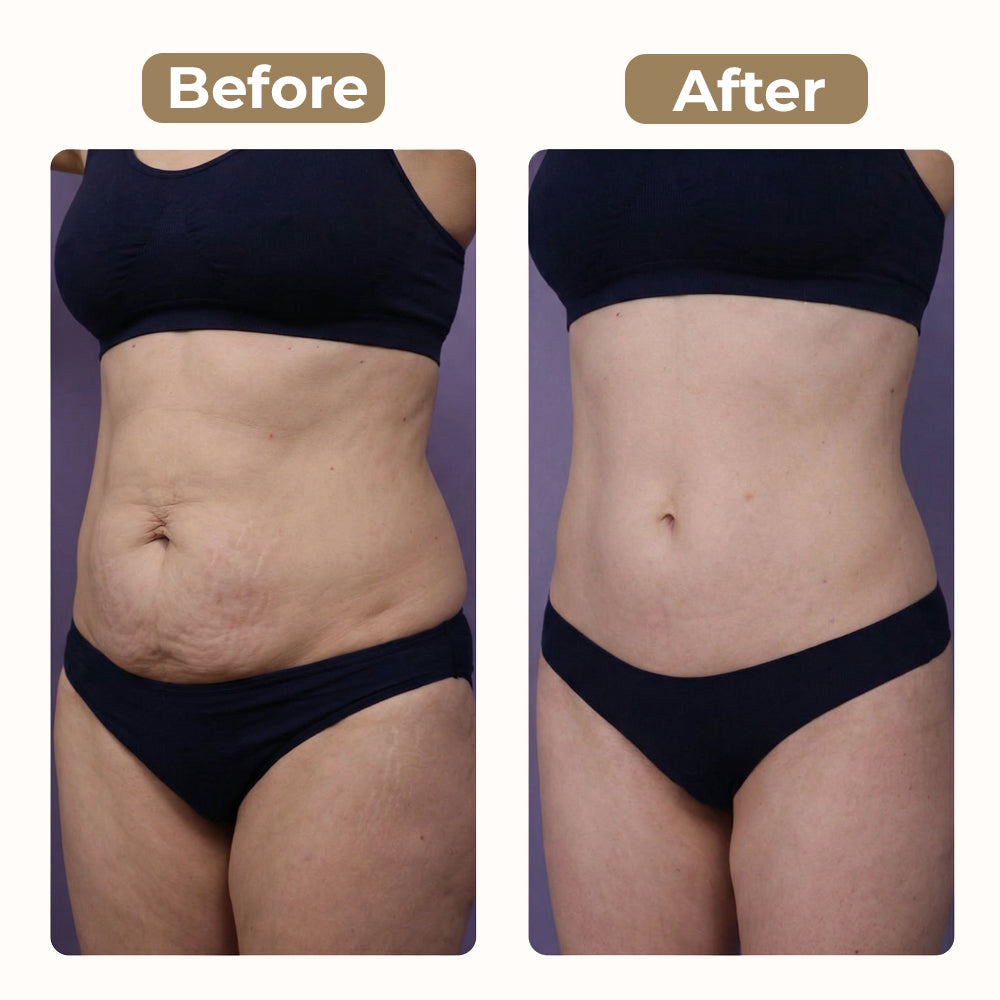 Ultrasonic Body Sculpting Massager – At-Home Firming & Contour Support