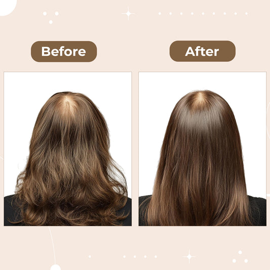 Scalp Massager Spray Brush - Science-Backed Brush