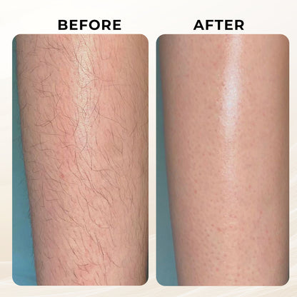 Rechargeable Hair Epilator - Electric Tweezers for Legs and Arms