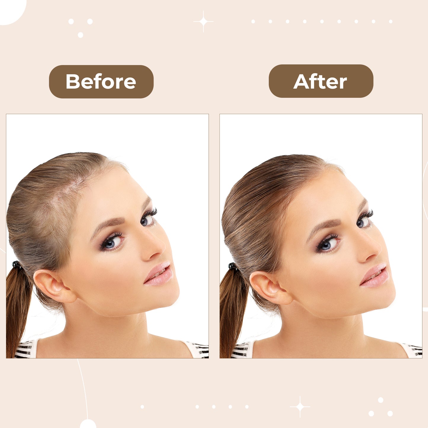 Scalp Massager Spray Brush - Science-Backed Brush